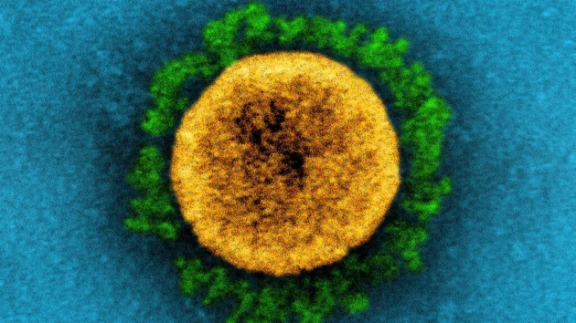 Covid-19：オミクロンの新型イテレーション「BA.2」が台頭