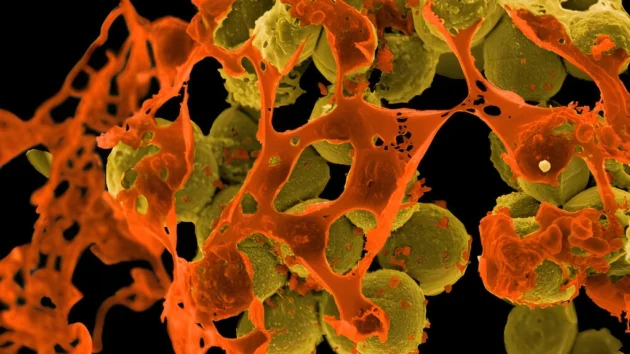 抗生物質耐性を高める危険性
